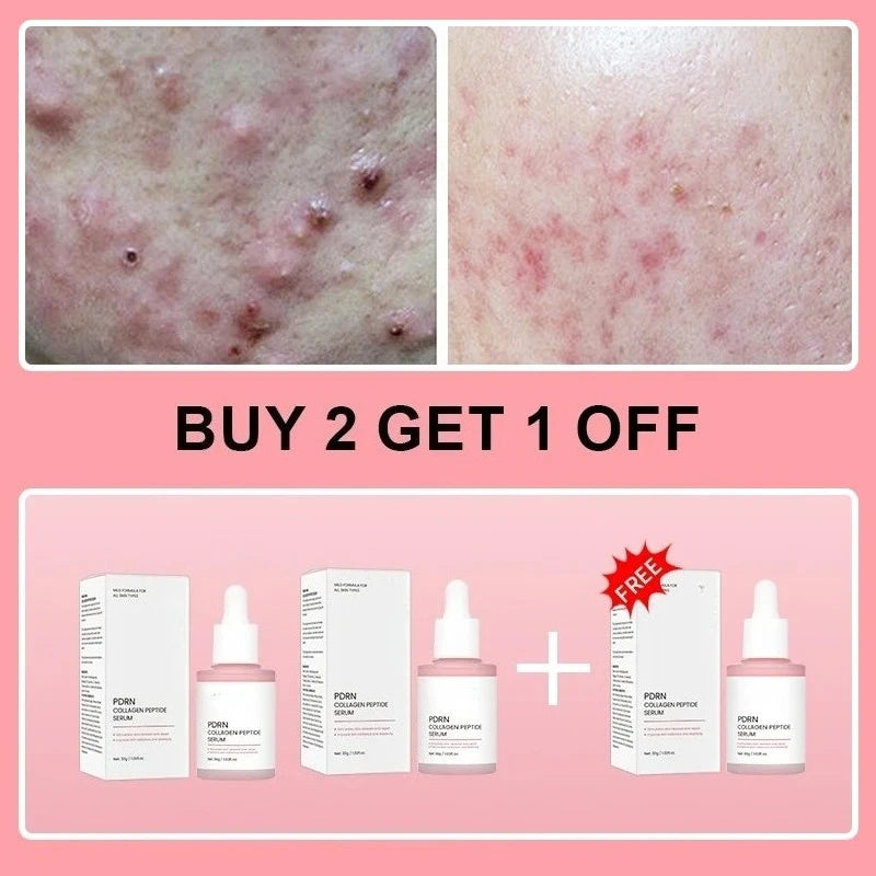 Salmon PDRN Collagen Peptide Facial Serum