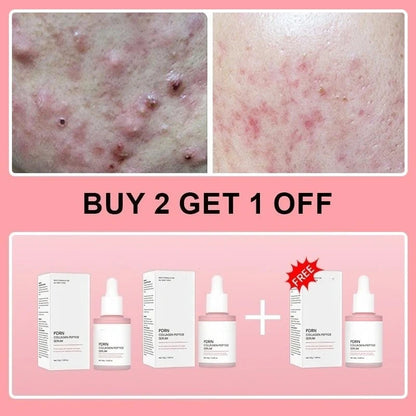 Salmon PDRN Collagen Peptide Facial Serum
