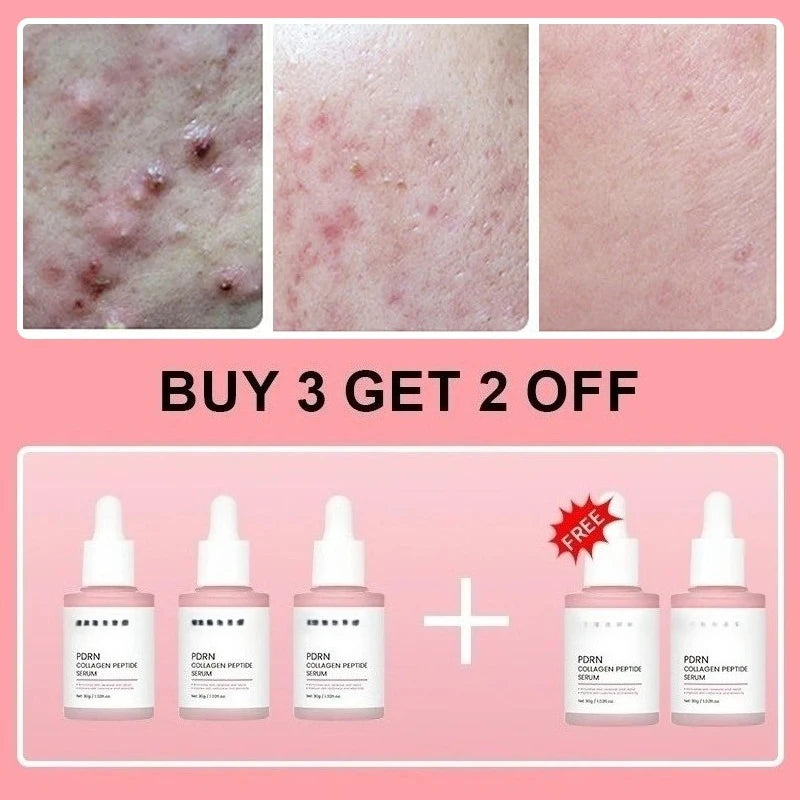 Salmon PDRN Collagen Peptide Facial Serum