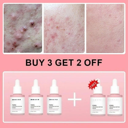 Salmon PDRN Collagen Peptide Facial Serum